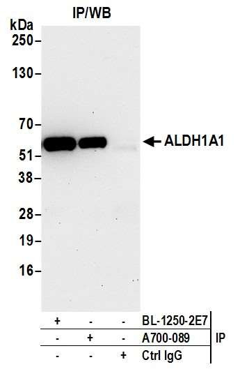 ALDH1A1 Antibody in Immunoprecipitation (IP)