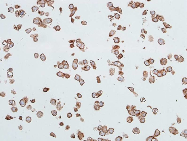 CEACAM1 Antibody in Immunocytochemistry (ICC/IF)