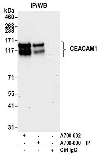 CEACAM1 Antibody in Immunoprecipitation (IP)