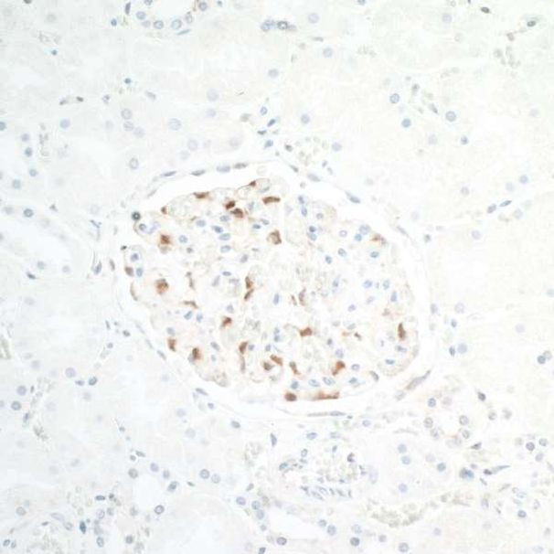 TJP1/ZO-1 Antibody in Immunohistochemistry (Paraffin) (IHC (P))