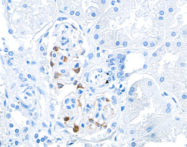 TJP1/ZO-1 Antibody in Immunohistochemistry (Paraffin) (IHC (P))