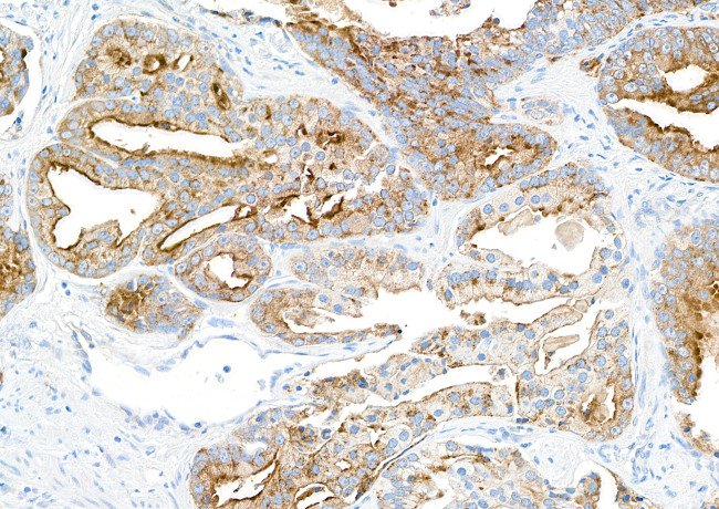 TJP1/ZO-1 Antibody in Immunohistochemistry (Paraffin) (IHC (P))