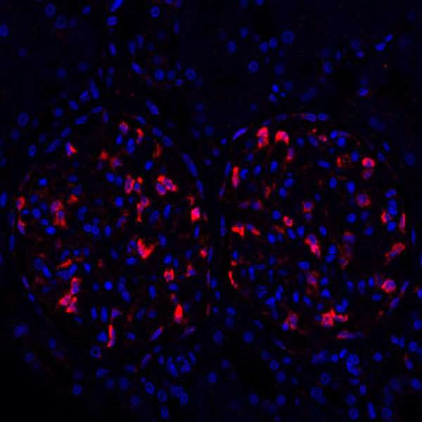 TJP1/ZO-1 Antibody in Immunohistochemistry (Paraffin) (IHC (P))