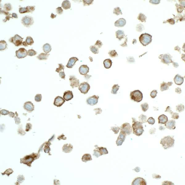 Claudin-1 Antibody in Immunocytochemistry (ICC/IF)