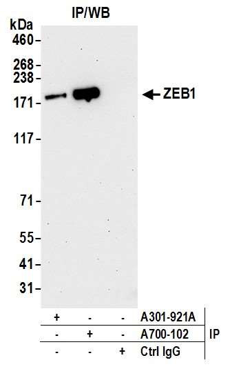 ZEB1 Antibody in Immunoprecipitation (IP)