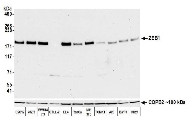 ZEB1 Antibody in Western Blot (WB)