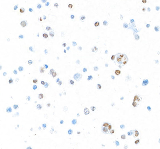 T-bet/TBX21 Antibody in Immunocytochemistry (ICC/IF)