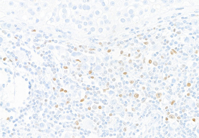 T-bet/TBX21 Antibody in Immunohistochemistry (Paraffin) (IHC (P))