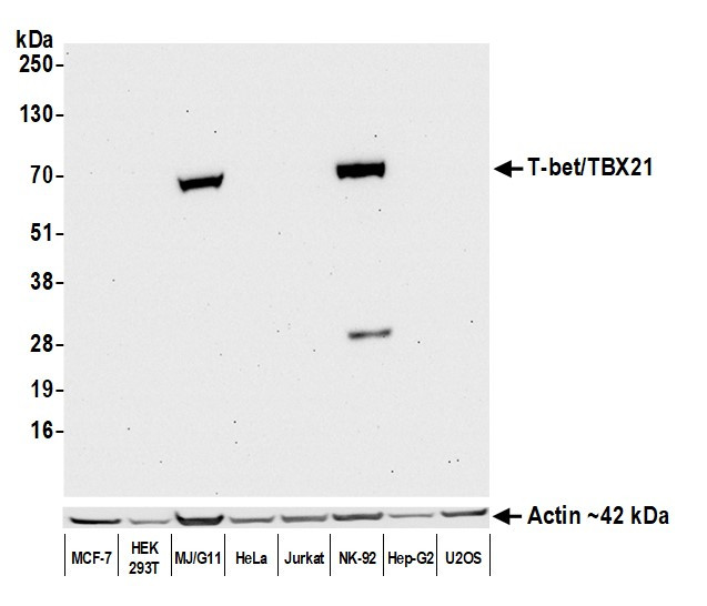 T-bet/TBX21 Antibody in Western Blot (WB)