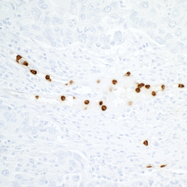 CEACAM8/CD66b Antibody in Immunohistochemistry (Paraffin) (IHC (P))