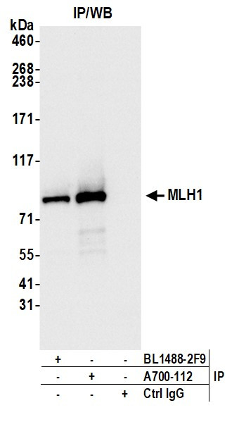 MLH1 Antibody in Immunoprecipitation (IP)