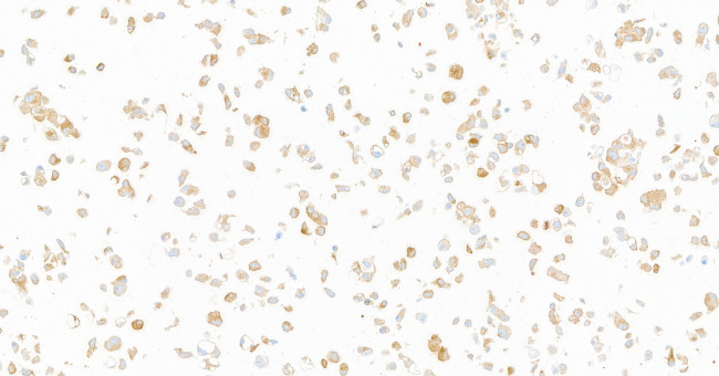 GP130/CD130 Antibody in Immunocytochemistry (ICC/IF)