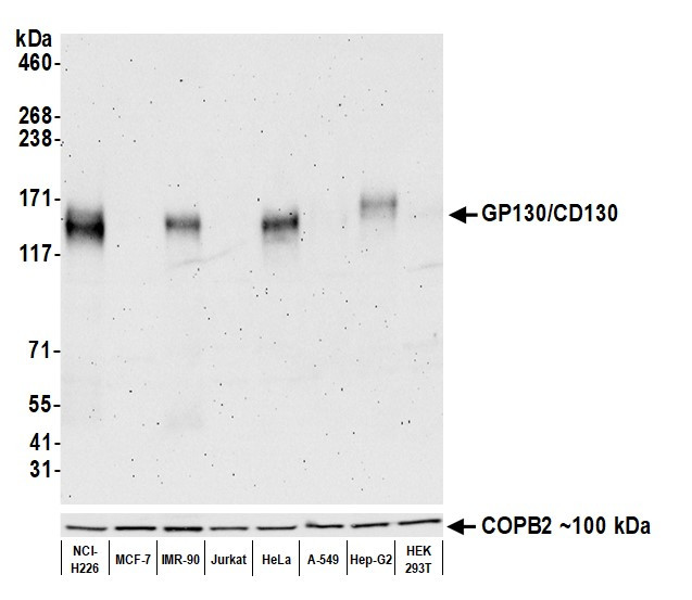 GP130/CD130 Antibody in Western Blot (WB)