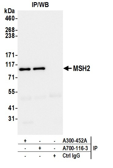 MSH2 Antibody in Immunoprecipitation (IP)