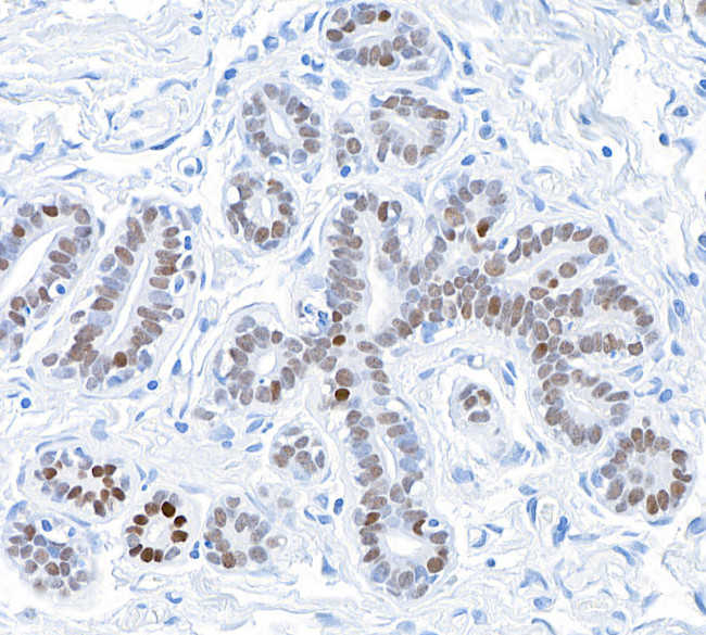 GATA3 Antibody in Immunohistochemistry (Paraffin) (IHC (P))