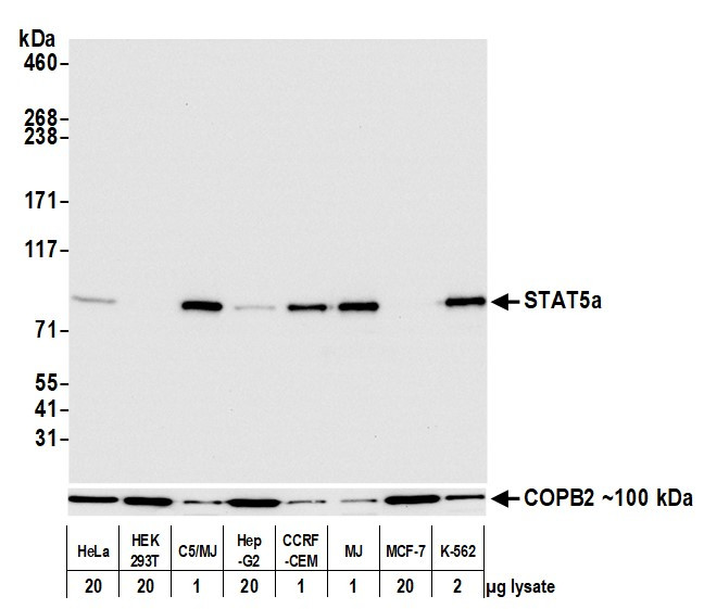 STAT5a Antibody in Western Blot (WB)