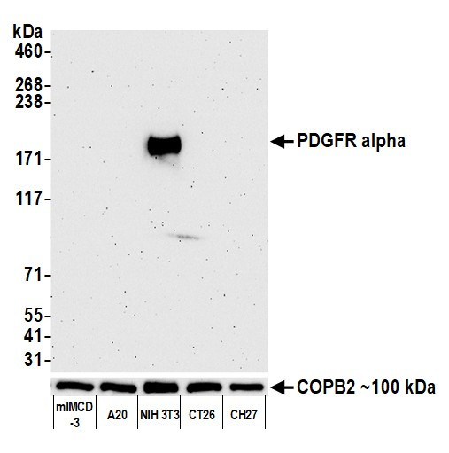PDGFR alpha Antibody in Western Blot (WB)