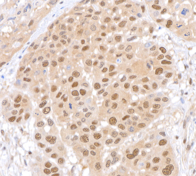 Lasu1/Ureb1 Antibody in Immunohistochemistry (Paraffin) (IHC (P))