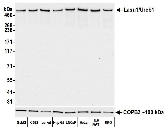 Lasu1/Ureb1 Antibody in Western Blot (WB)