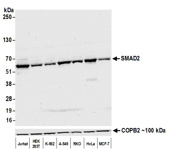 SMAD2 Antibody in Western Blot (WB)