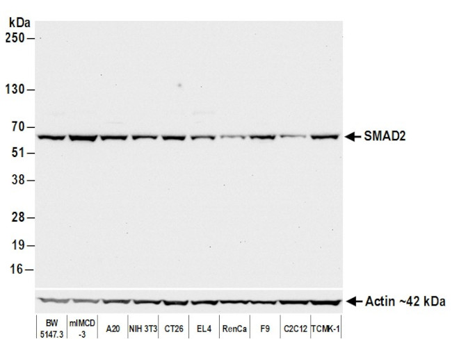 SMAD2 Antibody in Western Blot (WB)