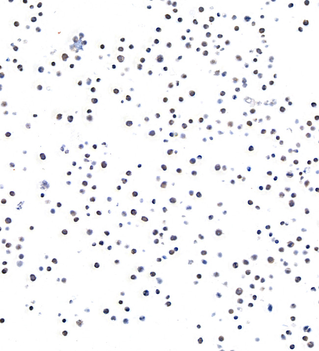 SMAD4 Antibody in Immunocytochemistry (ICC/IF)