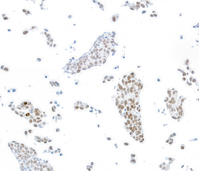 FOXP1 Antibody in Immunocytochemistry (ICC/IF)