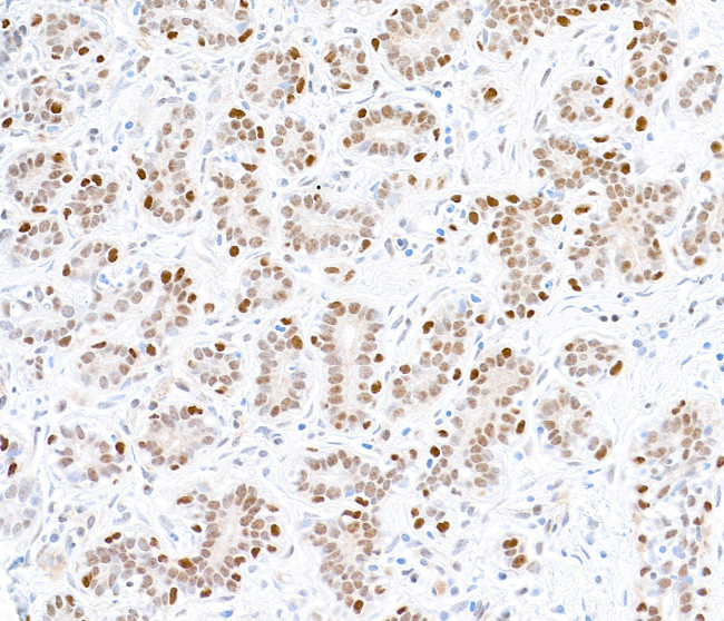 FOXP1 Antibody in Immunohistochemistry (Paraffin) (IHC (P))