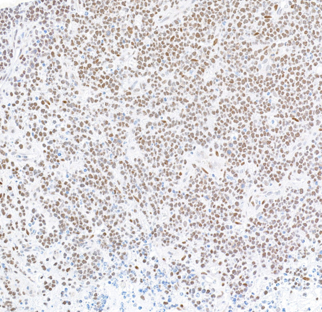 FOXP1 Antibody in Immunohistochemistry (Paraffin) (IHC (P))