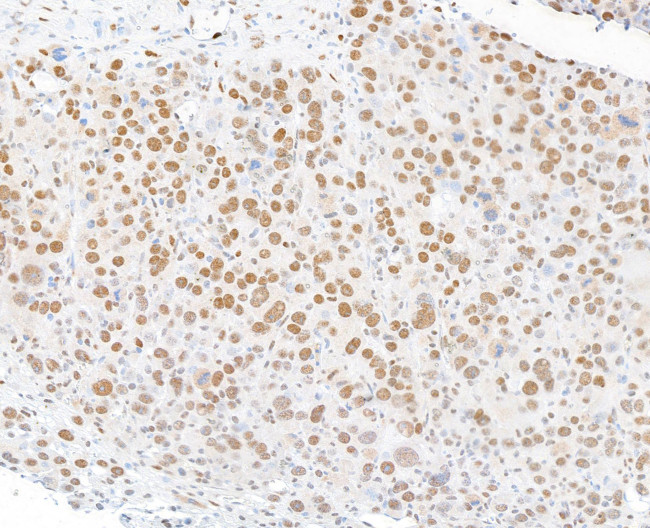 FOXP1 Antibody in Immunohistochemistry (Paraffin) (IHC (P))