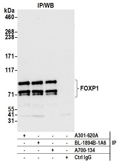 FOXP1 Antibody in Immunoprecipitation (IP)