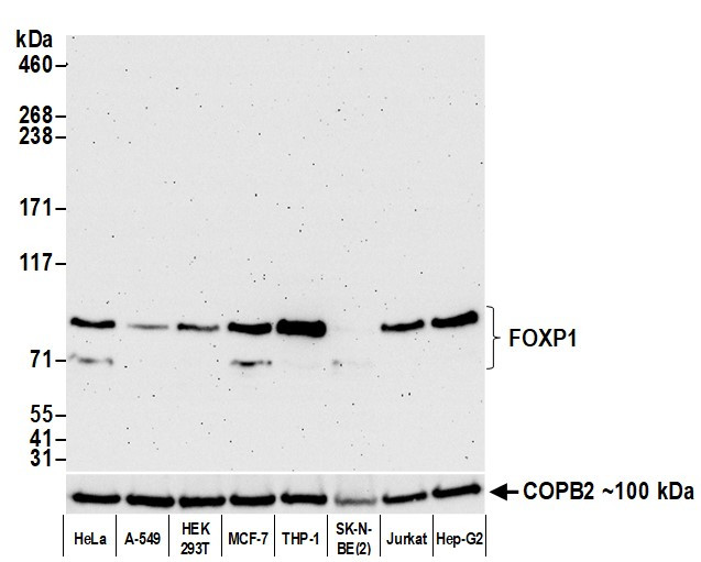 FOXP1 Antibody in Western Blot (WB)