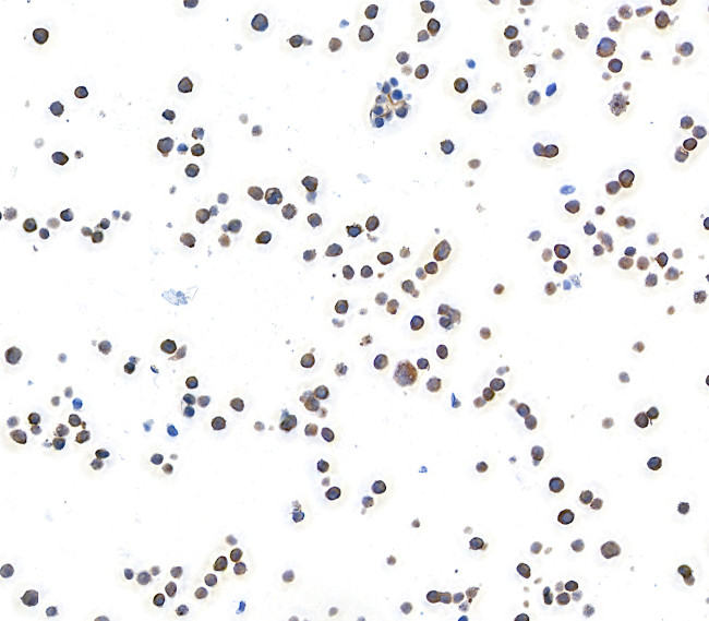 MACC1 Antibody in Immunocytochemistry (ICC/IF)