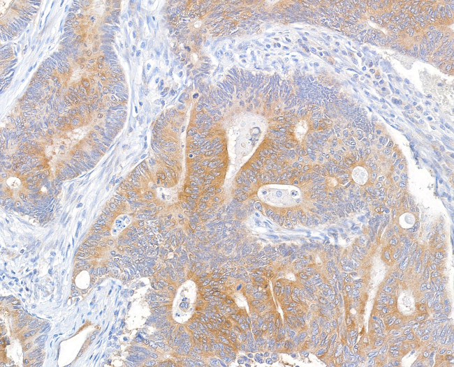 MACC1 Antibody in Immunohistochemistry (Paraffin) (IHC (P))