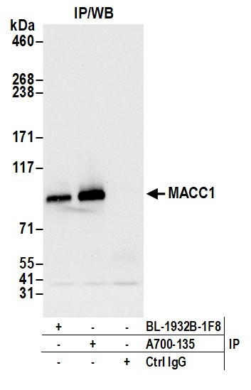 MACC1 Antibody in Immunoprecipitation (IP)