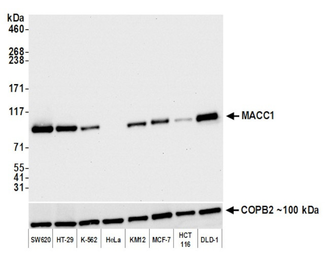 MACC1 Antibody in Western Blot (WB)