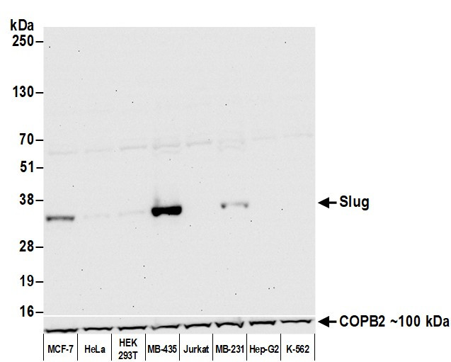 Slug Antibody in Western Blot (WB)