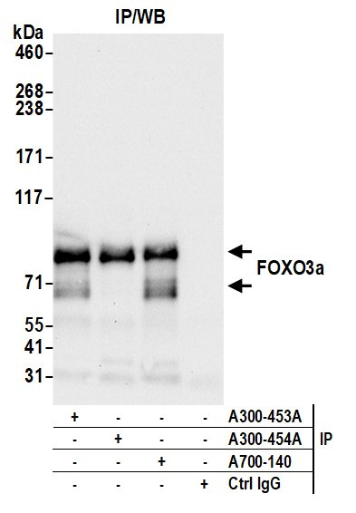 FOXO3a Antibody in Immunoprecipitation (IP)