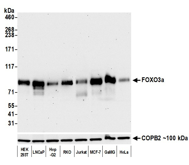 FOXO3a Antibody in Western Blot (WB)