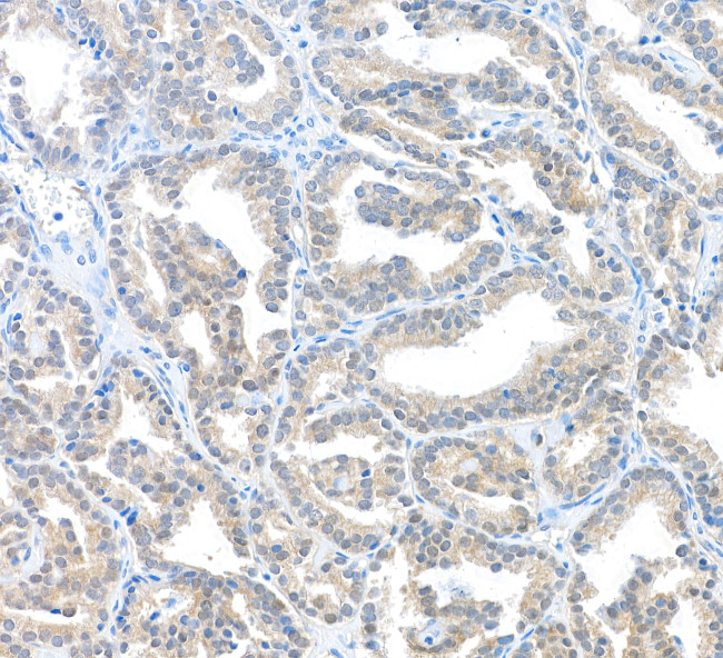 MIF Antibody in Immunohistochemistry (Paraffin) (IHC (P))