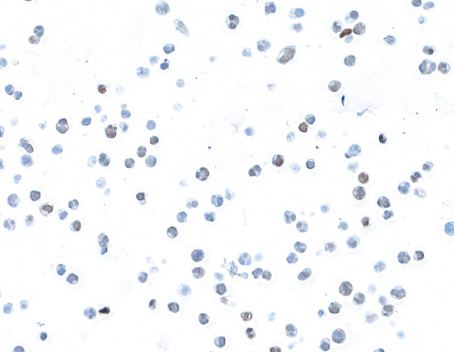 Bcl6 Antibody in Immunocytochemistry (ICC/IF)