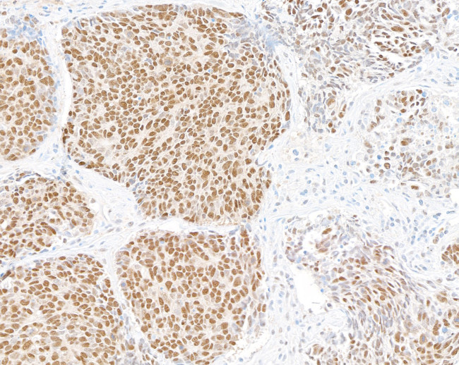 UBQLN4/CIP75/Ubiquilin 4 Antibody in Immunohistochemistry (Paraffin) (IHC (P))