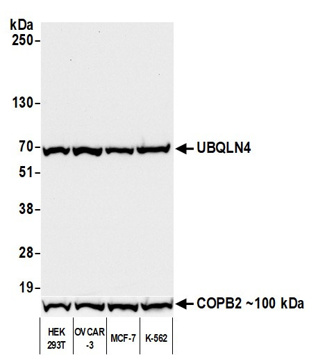 UBQLN4/CIP75/Ubiquilin 4 Antibody in Western Blot (WB)