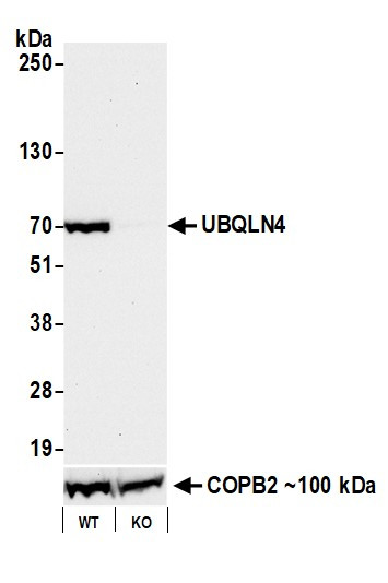 UBQLN4/CIP75/Ubiquilin 4 Antibody in Western Blot (WB)