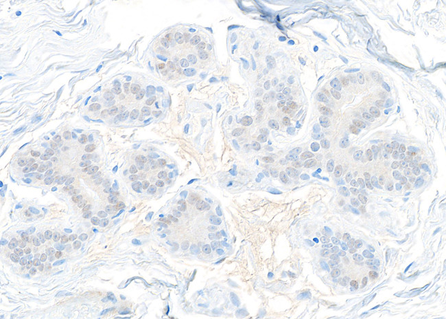 STAT5b Antibody in Immunohistochemistry (Paraffin) (IHC (P))