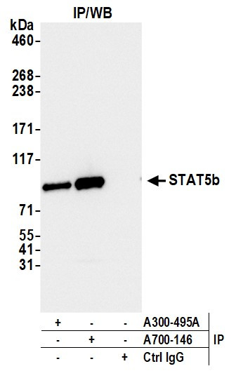 STAT5b Antibody in Immunoprecipitation (IP)