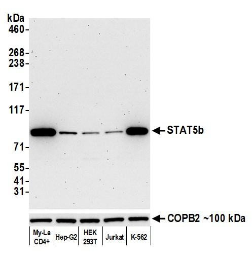 STAT5b Antibody in Western Blot (WB)