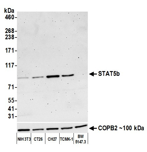 STAT5b Antibody in Western Blot (WB)