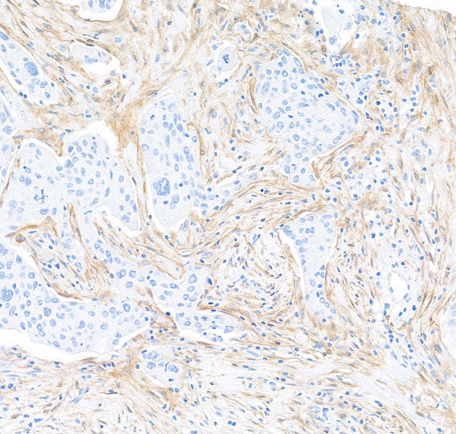 Fibroblast Activation Protein alpha/FAP Antibody in Immunohistochemistry (Paraffin) (IHC (P))