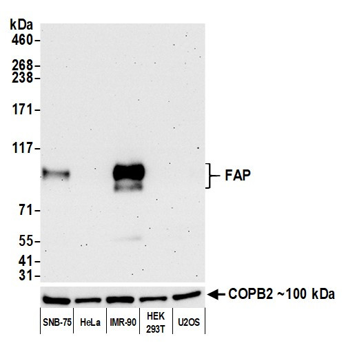 Fibroblast Activation Protein alpha/FAP Antibody in Western Blot (WB)